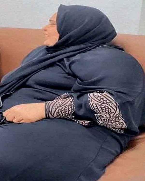 الحاجة أمينة م. قبل العملية